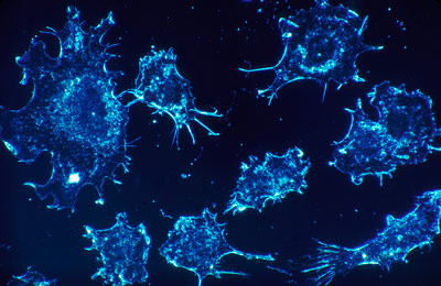 1-cancercell2918.jpg