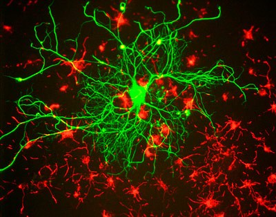 1-neuronacol0118.jpg