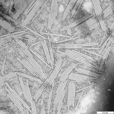 400Micrografía-electrónica-del-virus-del-mosaico-del-tabaco.-Rosalind-Franklin-trabajó-para-descubrir-la-estructura-tridimensional-de-este-virus.jpg