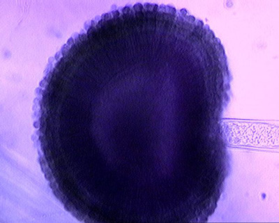 Aspergillus-niger-GH1.jpg