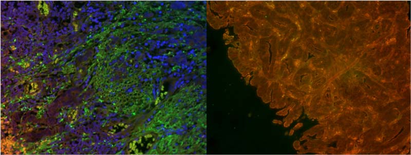 Inmunofluorescencia indirecta en corte de biopsia