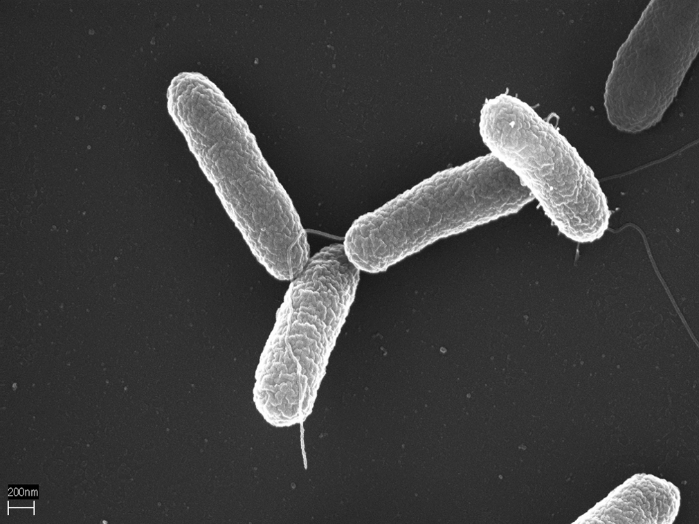 Salmonella enterica. Fotografía de Volker Brinkmann, Max Planck Institute for Infection Biology, Berlin, Germany.png