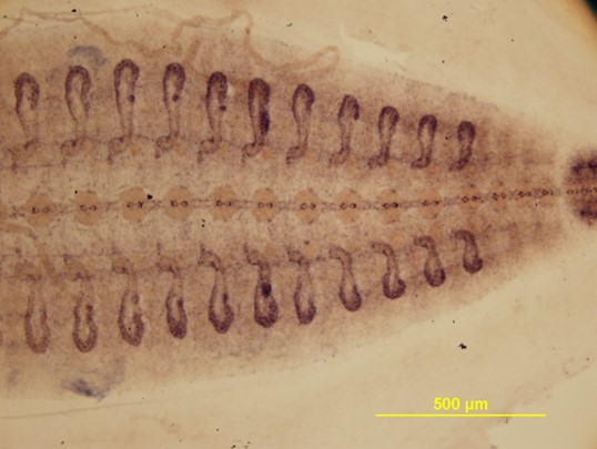 Expresion de inexinas en Hirudo medicinalis 2