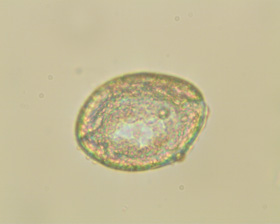 lecane quadridentata01