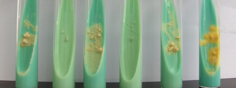 1 HEAD tuberculosis2605