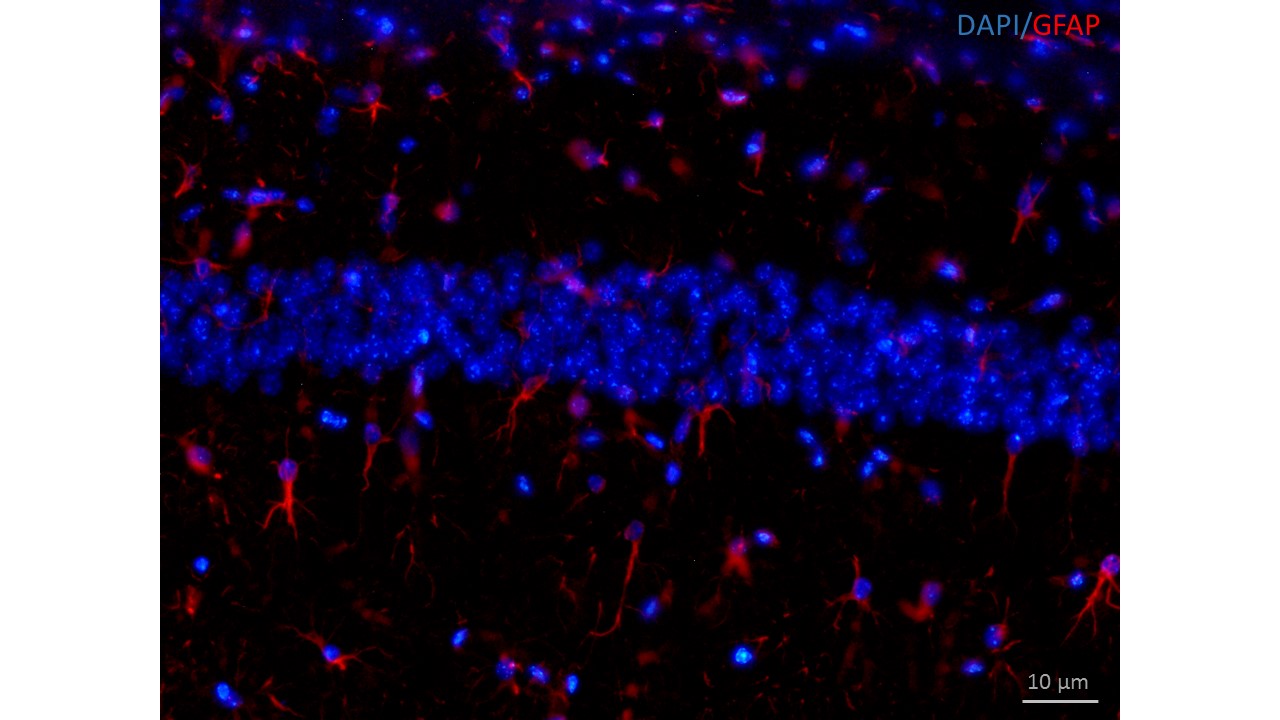 Astrocitos rojo en el hipocampo del raton