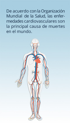 OMS enfermedades cardiovasculares