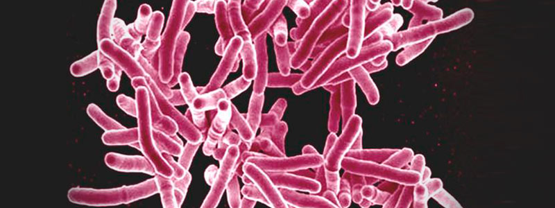 banner bacteria tuberculosis 22sncyt