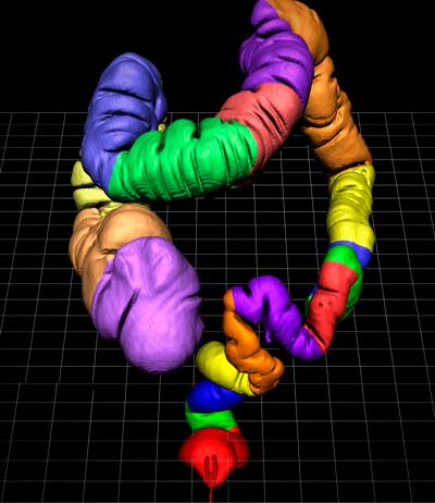 colon partition02