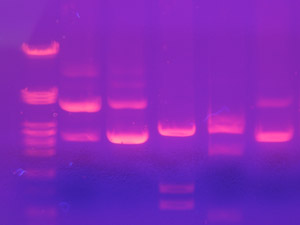 electroforesis01 huella genetica