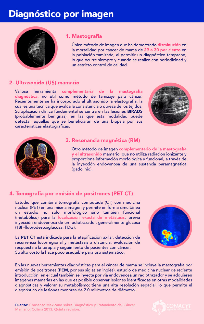 infografia diagnostico por imagen cancer seno