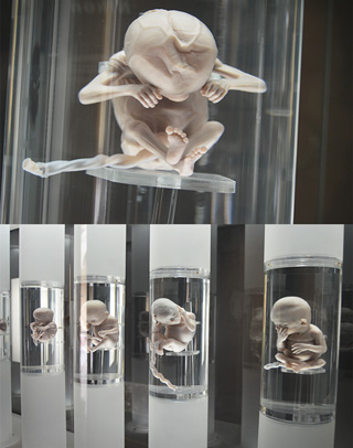 embriones museo medicina