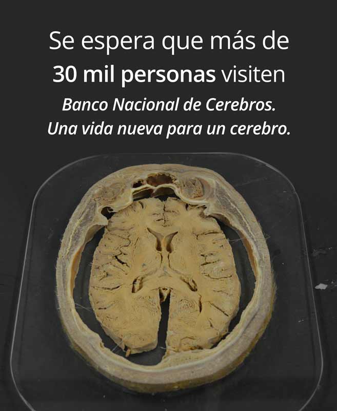 cerebro2